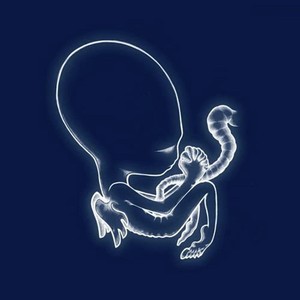 Sigur Rós - Ágatis Byrjun, Vinyl Album